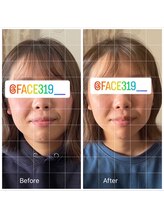 けんじ接骨院/小顔矯正（グリッド線有り）