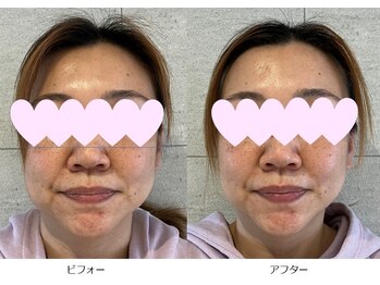 ベルメイク(BELLE MAKE)/美整コルギ☆ビフォーアフター