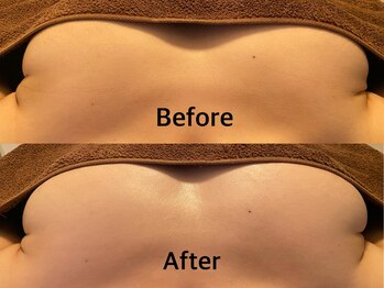 整顔整頭/【大きいお胸さん下垂予防】