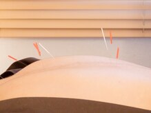 ハンドマイルド 赤坂 六本木(Hand Mild)/辛い部位を徹底改善