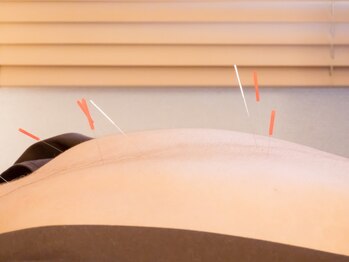 ハンドマイルド 赤坂 六本木(Hand Mild)/辛い部位を徹底改善