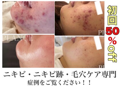 プランス 熊本(PLANCE)の写真