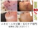 プランス 熊本(PLANCE)の写真