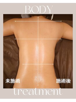 ルポ(repos)/骨格筋の調整効果