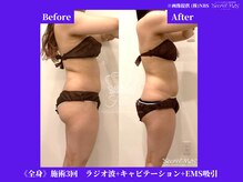 フェレザ 新潟(Felleza)/95％が1回目でもサイズダウン！
