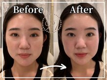 R-1ビューティーサロン 銀座/BEFORE＆AFTER　