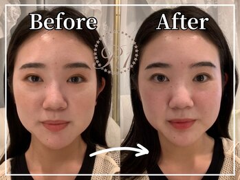 R-1ビューティーサロン 銀座/BEFORE＆AFTER　