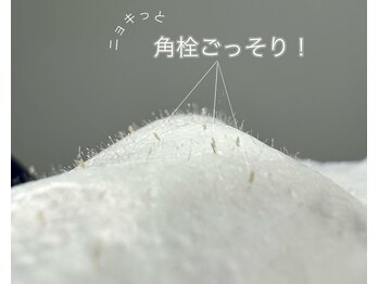 レアファースト/フェイスワックス