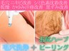 【W施術で効果抜群にＵＰ☆】美尻ハイドラ＋美尻ハーブピーリング18,700円！