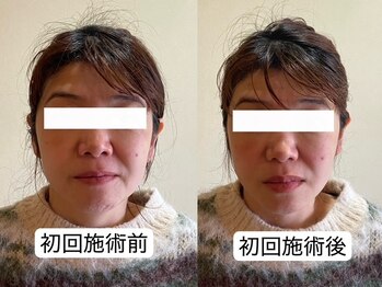 すわ鍼灸整骨院/1回の施術効果♪