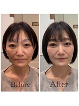 シャルム(Sharme)/お客様Before→After