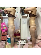 ポノ(Pono)/【痩身】サイドアングル