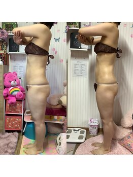 ポノ(Pono)/【痩身】サイドアングル