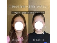 コア 心斎橋 堀江店(koa)/お客様ビフォーアフター