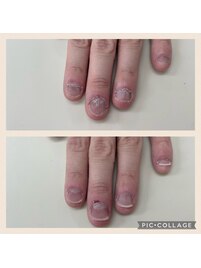 綺麗な自爪に変身！