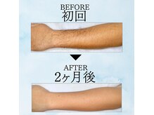 エクレ 柏店(EKURE)の雰囲気（猛暑が来る前に当店にて気になる毛をスッキリさせませんか！？）