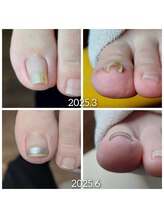 爪切り屋 足楽/