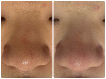 サイセイ(SAISEI)/