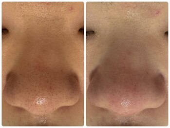 サイセイ(SAISEI)/