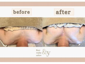 アンド ワイ(&y)/30代／出産歴2回