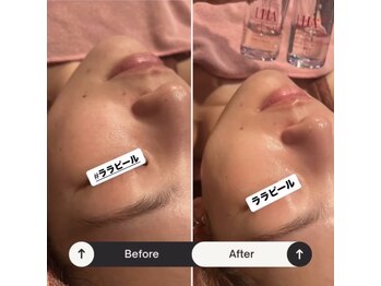 インフィニティ(INFINITY)/-LHA LHA PEEL -ララピール