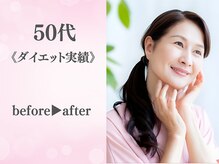 整体院カイト/50代/ビフォーアフター