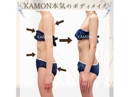 カモン(KAMON)の写真