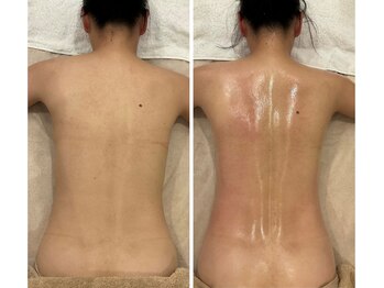 サンオーラ(SUN AURA)の写真/【発汗×全身脂肪燃焼】ムダ肉撃退！理想のボディラインをメイク◎部分引き締めも全身ケアもおまかせ！