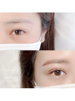 リヨン(LYON+831)/