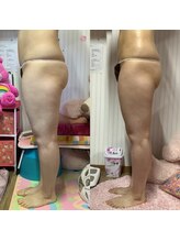 ポノ(Pono)/【痩身】サイドアングル下肢