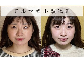 美容整体 アルマ/エラ、顎関節3ヶ月改善コース