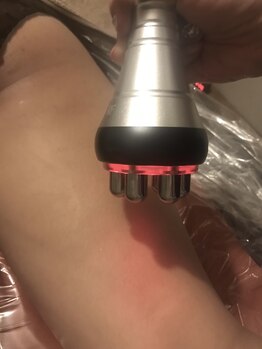 シャイニング(shining)/ラジオ波