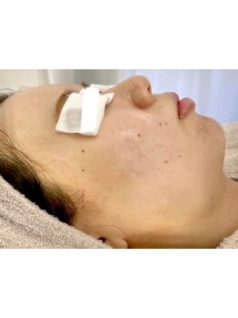 小顔になりたい