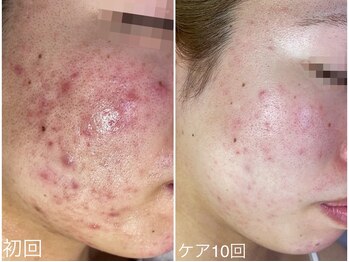 ラブリボン/短期プログラム