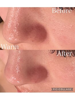 ウォーム(Warm)/毛穴ケアとハーブの相性は最高