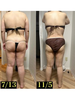 アモ(amo.)/ウィンバック効果写真