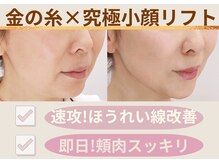 ミーティア(Meteor)