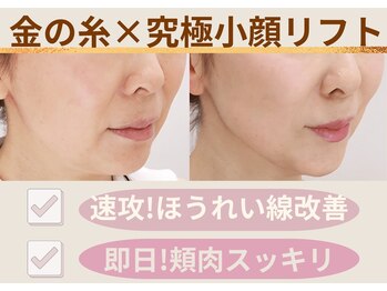 ミーティア(Meteor)