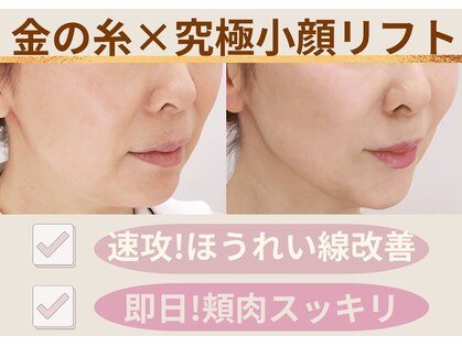 ミーティア(Meteor)の写真