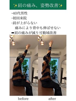 オルカ整体院(ORCA整体院)/【鹿児島/肩こり】
