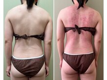 モモリラ(momorila)/セルクラ