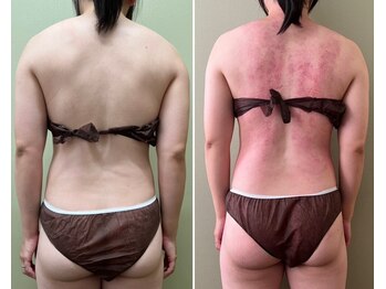 モモリラ(momorila)/セルクラ