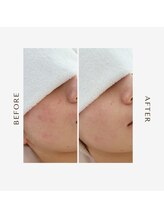 オーシャン(OCEAN)/ムートンホイップ＆ヘッドスパ