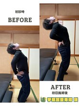 宇都宮整体院 咲/ビフォーアフター