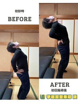 宇都宮整体院 咲/ビフォーアフター