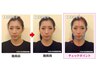 【理想のフェイスラインへ】大人気！！小顔矯正コース★￥12,900→￥5,000