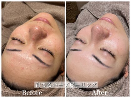 キュアルーム(CURE ROOM)の写真