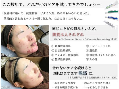 ビアンカの写真