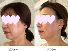 ベルメイク(BELLE MAKE)/美整コルギ☆ビフォーアフター横