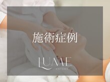 ルーミー 南青山(LUME)/当店の人気メニューの症例写真